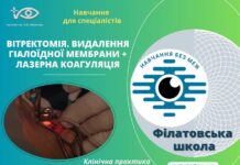 Запрошуємо вас на перегляд відео «Вітректомія. Видалення гіалоїдної мембрани + лазерна коагуляція»