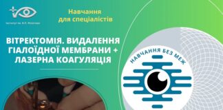 Запрошуємо вас на перегляд відео «Вітректомія. Видалення гіалоїдної мембрани + лазерна коагуляція»