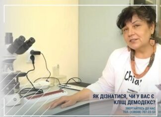 ЯК ДІЗНАТИСЯ, ЧИ У ВАС Є КЛІЩ ДЕМОДЕКС