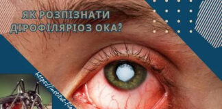 Як розпізнати дірофіляріоз ока