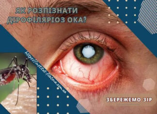 Як розпізнати дірофіляріоз ока