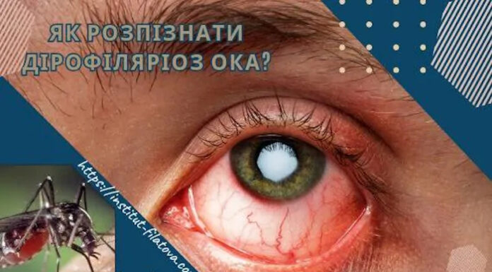 Як розпізнати дірофіляріоз ока