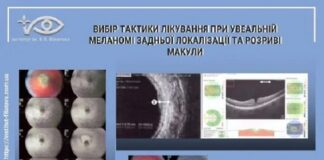 Вибір тактики лікування при увеальній меланомі задньої локалізації та розриві макули