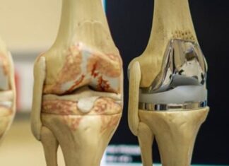 Фахова школа «Сучасні технології в хірургічному лікуванні травм та захворювань колінного суглоба»