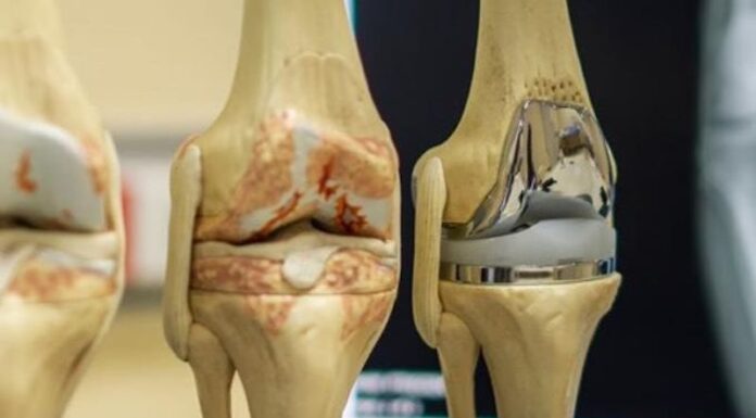 Фахова школа «Сучасні технології в хірургічному лікуванні травм та захворювань колінного суглоба»