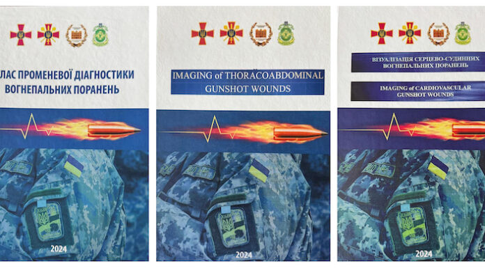 Вийшли в світ 14, 15 та 16-та колективні монографії серії книг науковців НАМН України, військових медиків та МОЗ України, які узагальнюють бойовий досвід медичного забезпечення наших захисників під час війни