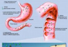 Методичні рекомендацій «Сучасні підходи до діагностики, лікування та профілактики антибіотико-асоційованої діареї»