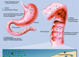 Методичні рекомендацій «Сучасні підходи до діагностики, лікування та профілактики антибіотико-асоційованої діареї»