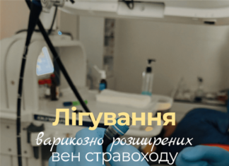 Лігування варикозно розширених вен стравоходу