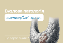 Вузли щитоподібної залози – патологія або норма?