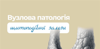 Вузли щитоподібної залози – патологія або норма?