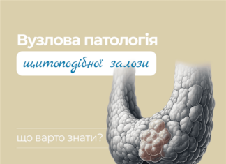 Вузли щитоподібної залози – патологія або норма?