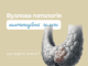 Вузли щитоподібної залози – патологія або норма?