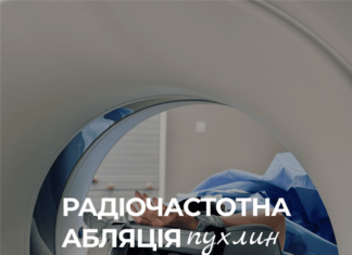 Радіочастотна абляція пухлин