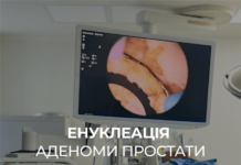 Енуклеація аденоми простати