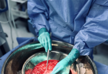 Родинна трансплантація печінки