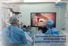ЛІКУВАННЯ ВІТРЕАЛЬНОГО КРОВОВИЛИВУ ПРИ ДІАБЕТИЧНІЙ РЕТИНОПАТІЇ