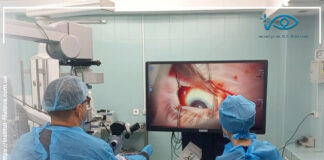 ЛІКУВАННЯ ВІТРЕАЛЬНОГО КРОВОВИЛИВУ ПРИ ДІАБЕТИЧНІЙ РЕТИНОПАТІЇ