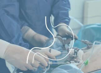 Баріатрична хірургія