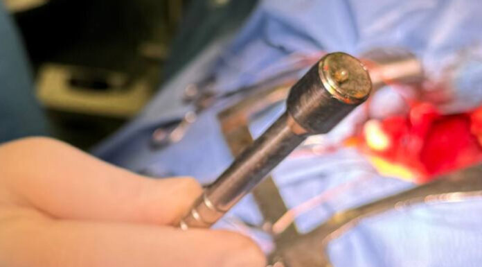 Металевий уламок, який застряг у перикарді правого шлуночка, ледь не забрав життя військового