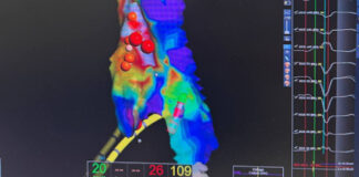 Операційний день без жодного рентген-знімка — заради здоров’я наших захисників!