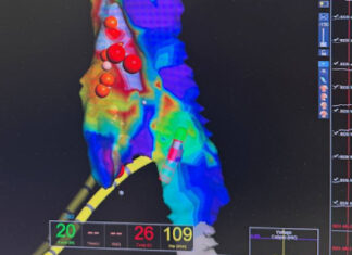 Операційний день без жодного рентген-знімка — заради здоров’я наших захисників!