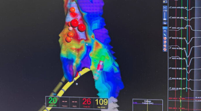 Операційний день без жодного рентген-знімка — заради здоров’я наших захисників!