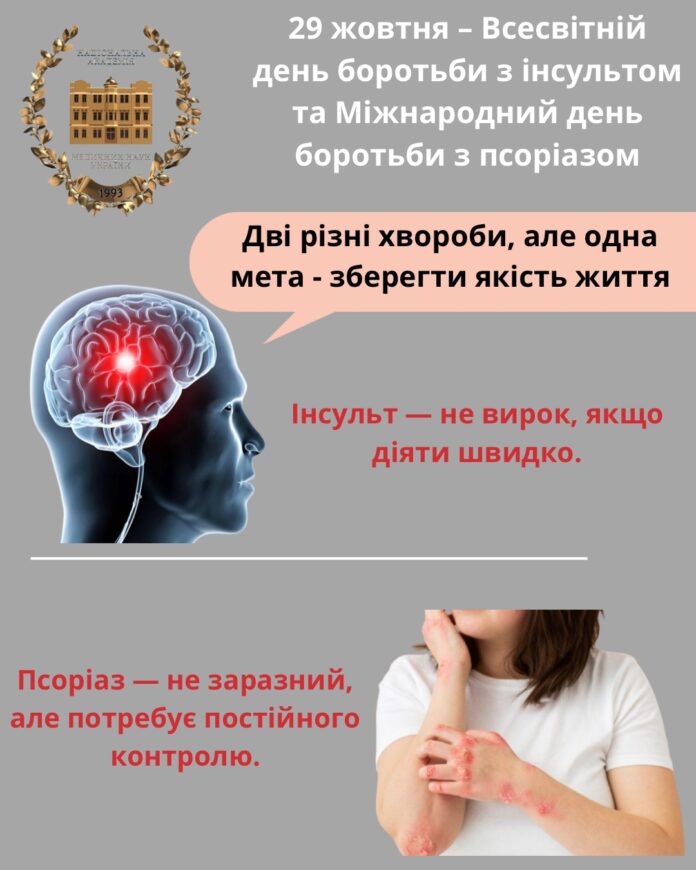 29 жовтня – Всесв〓тн〓и〓 день боротьби з інсультом та М〓жнароднии〓 день боротьби з псоріазом