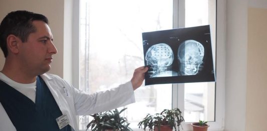 До дня обізнаності про травми мозку: історія, що рятує життя